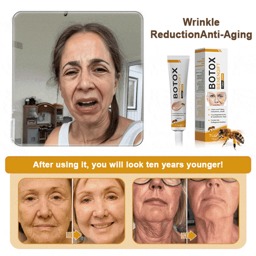 TLOPA® 🌿 Botox Bee Venom Wrinkle Removal Cream