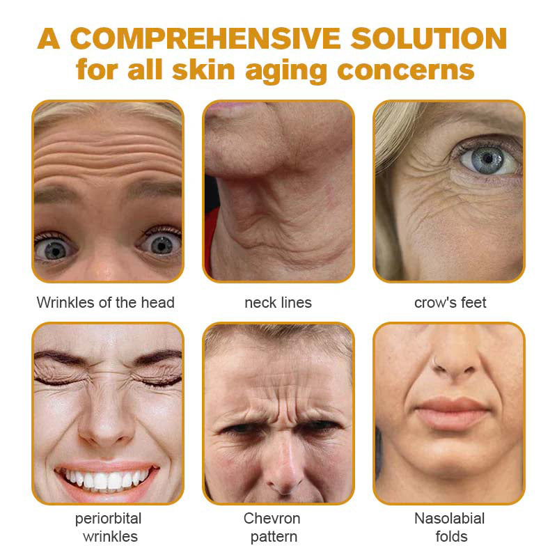TLOPA® 🌿 Botox Bee Venom Wrinkle Removal Cream