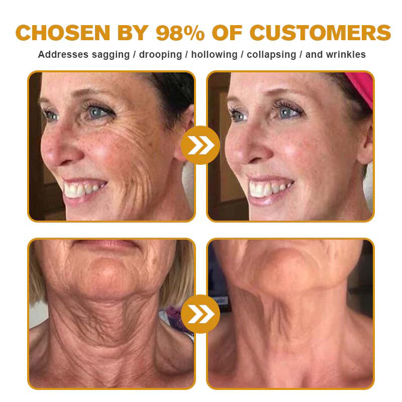 TLOPA® 🌿 Botox Bee Venom Wrinkle Removal Cream