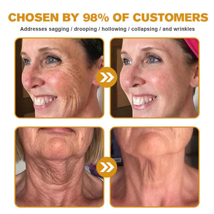 TLOPA® 🌿 Botox Bee Venom Wrinkle Removal Cream