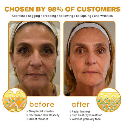 TLOPA® 🌿 Botox Bee Venom Wrinkle Removal Cream